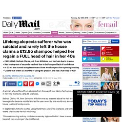 alopecia treatment