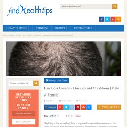 Hair Loss Causes - Diseases and Conditions [Male & Female]