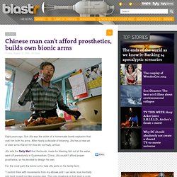 Chinese man can't afford prosthetics, builds own bionic arms