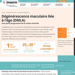 Dégénérescence maculaire liée à l’âge (DMLA)