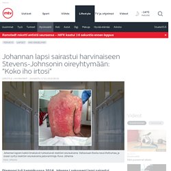 Johannan lapsi sairastui harvinaiseen Stevens-Johnsonin oireyhtymään: ”Koko iho irtosi” - Lifestyle