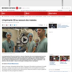 L’imprimante 3D au secours des malades