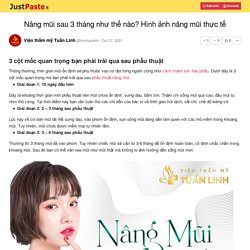 Nâng mũi sau 3 tháng như thế nào? Hình ảnh nâng mũi thực tế
