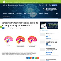 Serotonin System Malfunction Could Be an Early Warning for Parkinson's